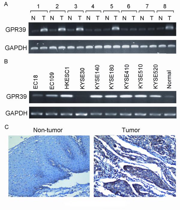 https://cdn.ncbi.nlm.nih.gov/pmc/blobs/ec13/3053269/d53f091aa0c3/1471-2407-11-86-1.jpg