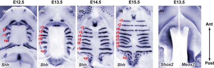 https://cdn.ncbi.nlm.nih.gov/pmc/blobs/ec1b/10234451/894d011bb5de/ODI-28-1306-g002.jpg