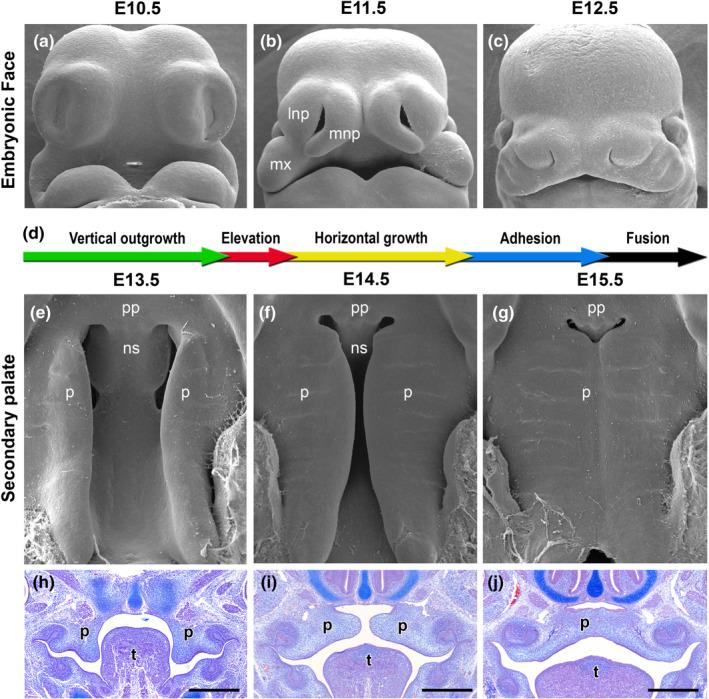 https://cdn.ncbi.nlm.nih.gov/pmc/blobs/ec1b/10234451/b4fe5960df35/ODI-28-1306-g001.jpg