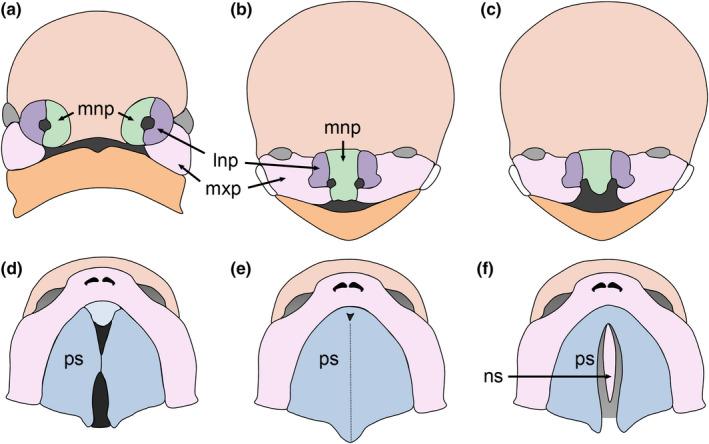 https://cdn.ncbi.nlm.nih.gov/pmc/blobs/ec1b/10234451/dbc769fc7b68/ODI-28-1306-g006.jpg