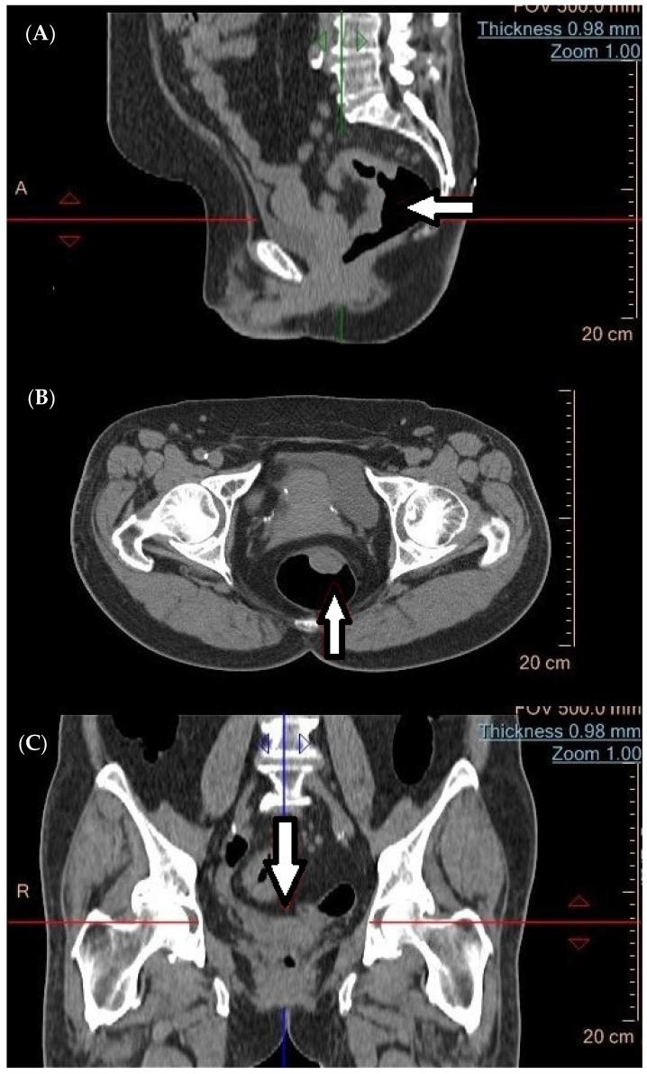 https://cdn.ncbi.nlm.nih.gov/pmc/blobs/ec1c/11275086/04ffac5a52dd/cancers-16-02553-g001.jpg