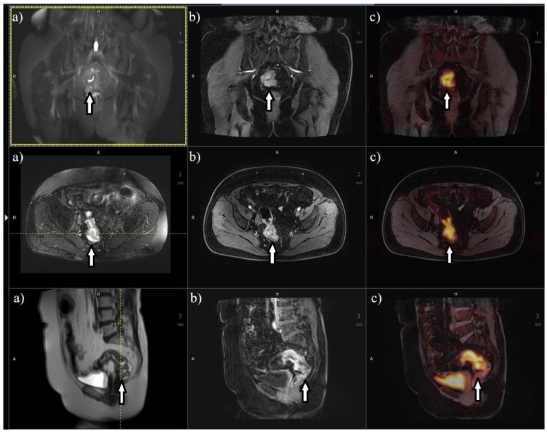 https://cdn.ncbi.nlm.nih.gov/pmc/blobs/ec1c/11275086/ae08870d5578/cancers-16-02553-g003.jpg