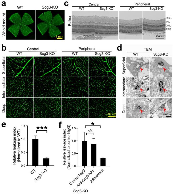 https://cdn.ncbi.nlm.nih.gov/pmc/blobs/ec20/10341987/fdf231de58a2/ijms-24-10531-g007.jpg