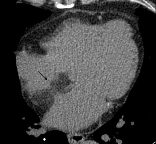 https://cdn.ncbi.nlm.nih.gov/pmc/blobs/ec23/4043540/7749b1ea3655/medscimonit-20-833-g002.jpg