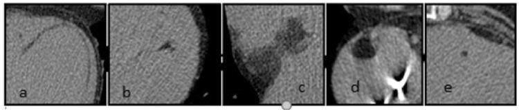 https://cdn.ncbi.nlm.nih.gov/pmc/blobs/ec23/4043540/7d51a34bee97/medscimonit-20-833-g001.jpg