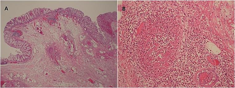 https://cdn.ncbi.nlm.nih.gov/pmc/blobs/ec23/7490986/a865b2638893/gr1.jpg