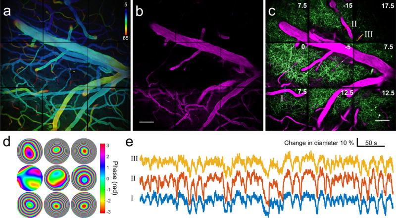 https://cdn.ncbi.nlm.nih.gov/pmc/blobs/ec2b/5482233/e10374d31014/nihms868386f3.jpg