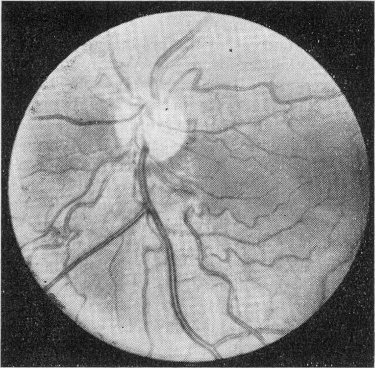 https://cdn.ncbi.nlm.nih.gov/pmc/blobs/ec33/1812082/de4743f82fc9/procrsmed00280-0092-a.jpg