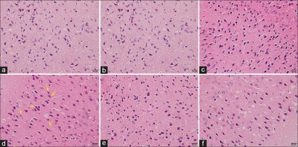https://cdn.ncbi.nlm.nih.gov/pmc/blobs/ec3b/6202591/b957432ce532/CMJ-131-2447-g007.jpg