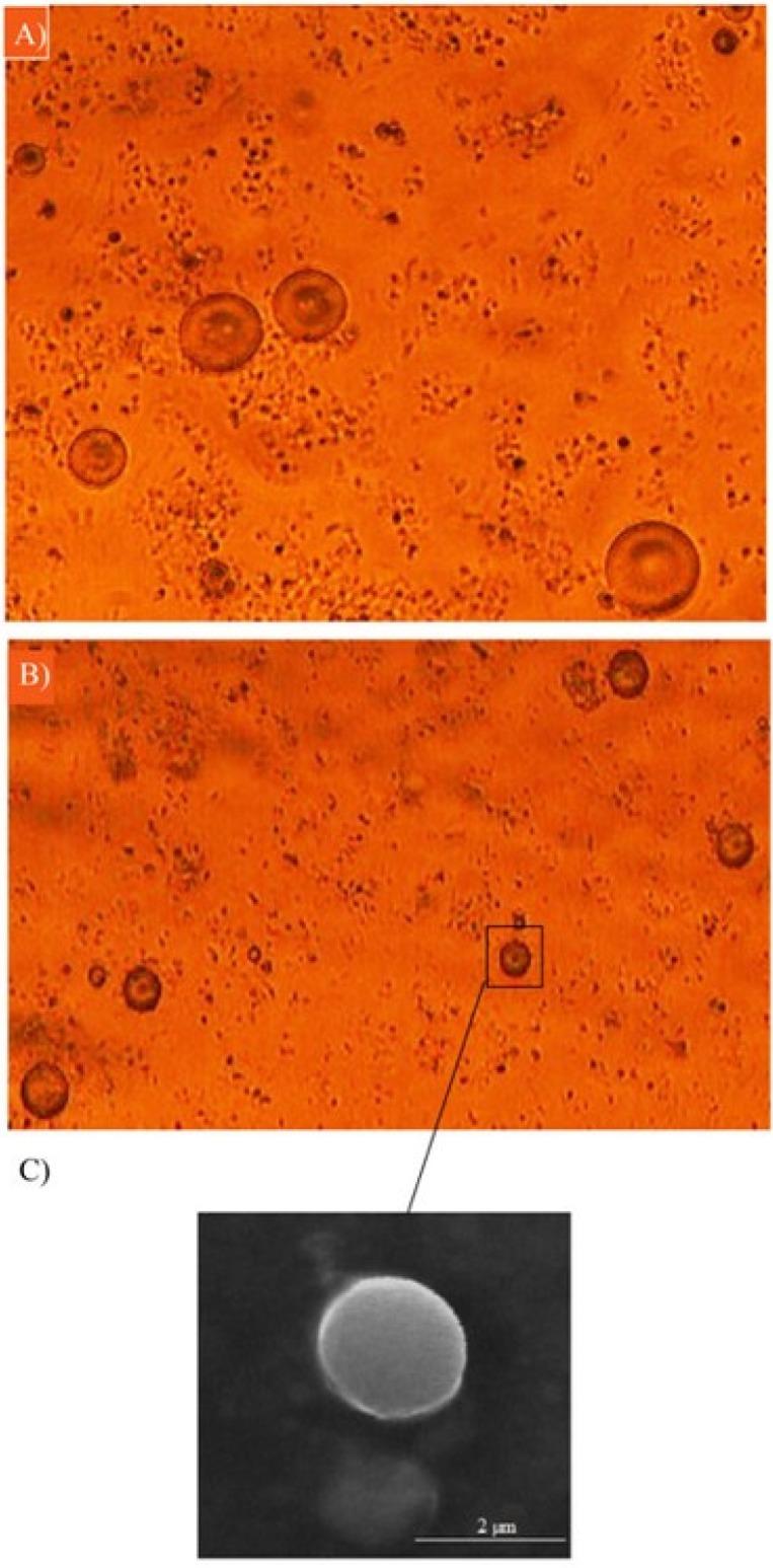 https://cdn.ncbi.nlm.nih.gov/pmc/blobs/ec41/5985165/d4c0318673c2/ijpr-17-470-g002.jpg