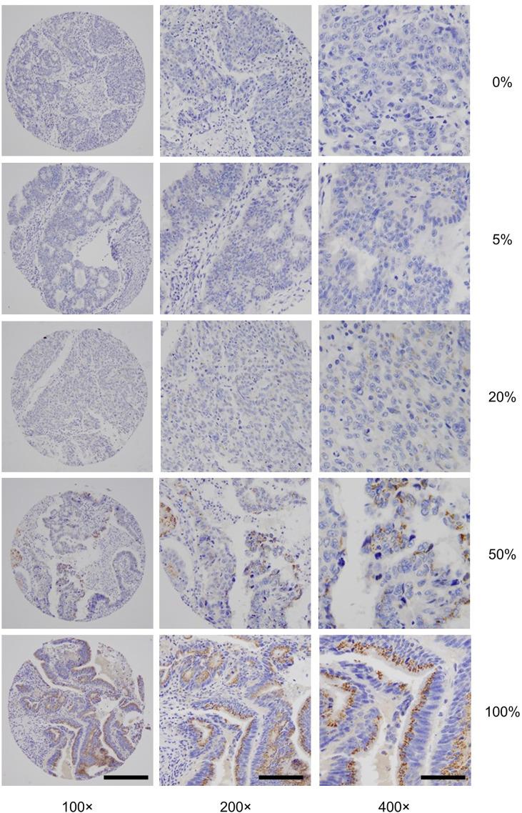 https://cdn.ncbi.nlm.nih.gov/pmc/blobs/ec45/9185839/67c8d35dd8fa/fonc-12-802548-g001.jpg
