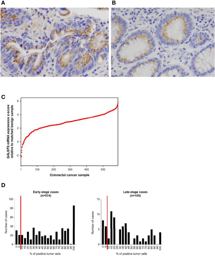 https://cdn.ncbi.nlm.nih.gov/pmc/blobs/ec45/9185839/bafb59db5245/fonc-12-802548-g002.jpg