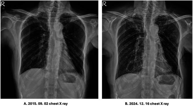 https://cdn.ncbi.nlm.nih.gov/pmc/blobs/ec53/12223654/b69d71dc6007/in_vivo-39-2230-g0001.jpg