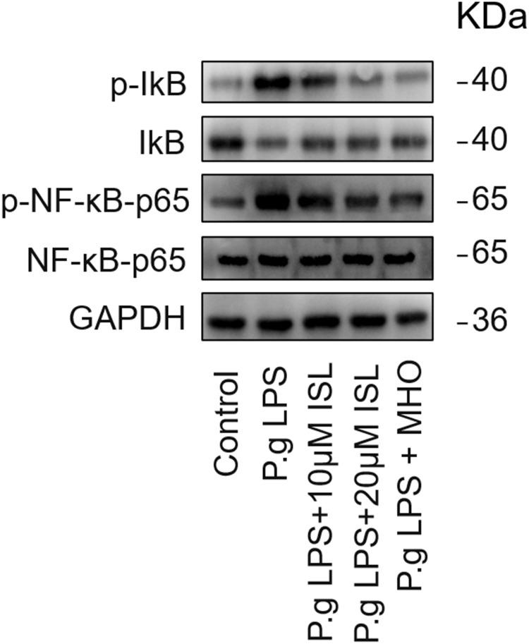 https://cdn.ncbi.nlm.nih.gov/pmc/blobs/ec60/12079120/87bc8c8769f6/JIR-18-6133-g0008.jpg