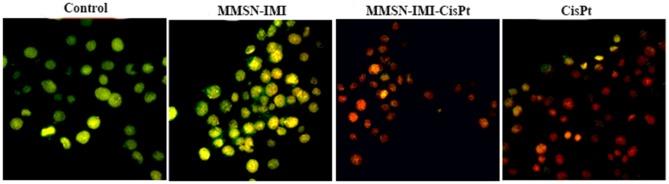 https://cdn.ncbi.nlm.nih.gov/pmc/blobs/ec65/7182466/d96418a58389/IJN-15-2617-g0008.jpg