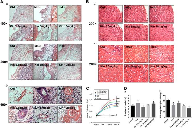 https://cdn.ncbi.nlm.nih.gov/pmc/blobs/ec78/5059859/f4b83457ee4a/cddis2016255f8.jpg