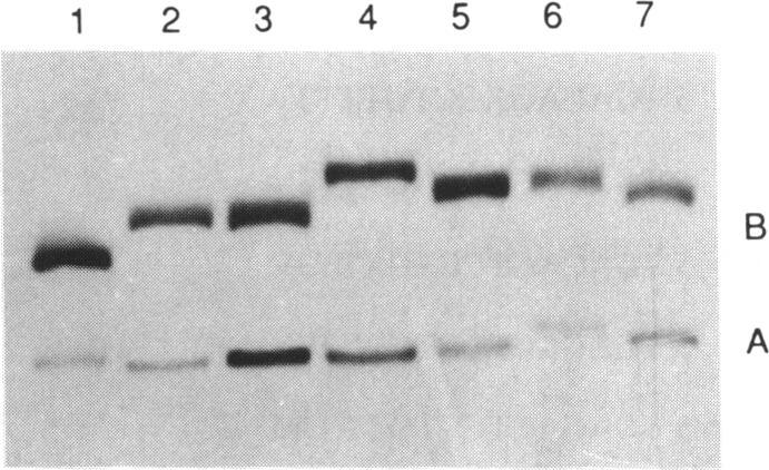 https://cdn.ncbi.nlm.nih.gov/pmc/blobs/ec82/309093/0a3c95a59dde/nar00051-0037-a.jpg
