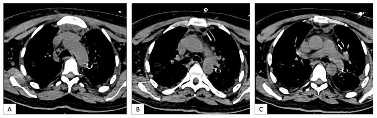 https://cdn.ncbi.nlm.nih.gov/pmc/blobs/ec84/11051203/e34d85cc363a/jcm-13-02440-g002.jpg
