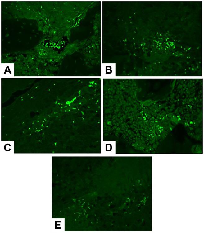 https://cdn.ncbi.nlm.nih.gov/pmc/blobs/ec85/12223653/52e36a3c4163/in_vivo-39-1988-g0001.jpg