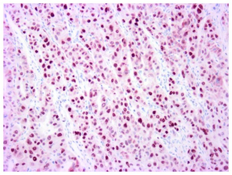 https://cdn.ncbi.nlm.nih.gov/pmc/blobs/ec99/5649005/0a36e4ddd55f/mco-07-05-0777-g11.jpg