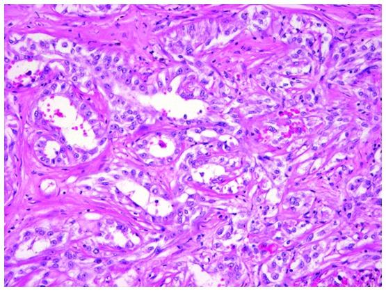 https://cdn.ncbi.nlm.nih.gov/pmc/blobs/ec99/5649005/72495515891a/mco-07-05-0777-g04.jpg