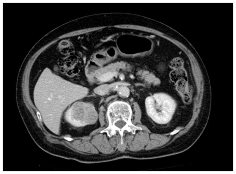https://cdn.ncbi.nlm.nih.gov/pmc/blobs/ec99/5649005/9da736f1893c/mco-07-05-0777-g01.jpg