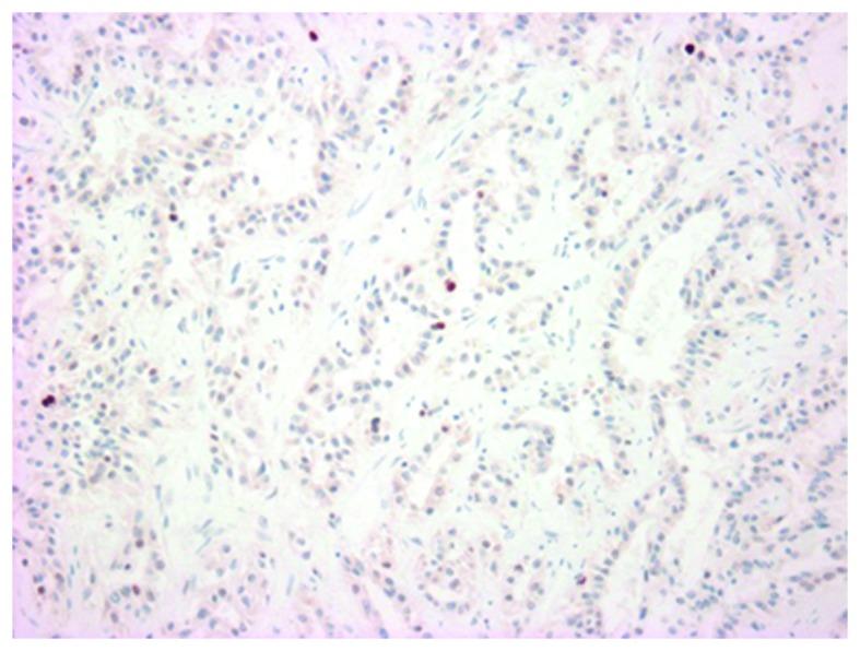 https://cdn.ncbi.nlm.nih.gov/pmc/blobs/ec99/5649005/ec4eaf8a3ae1/mco-07-05-0777-g09.jpg