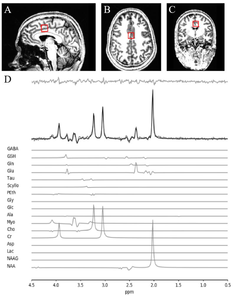 https://cdn.ncbi.nlm.nih.gov/pmc/blobs/eca5/8307096/fd8ccbb46cb2/brainsci-11-00941-g001.jpg