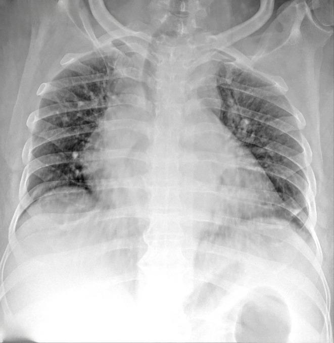 https://cdn.ncbi.nlm.nih.gov/pmc/blobs/eca7/11537182/99fdc6f65111/IMCRJ-17-895-g0002.jpg