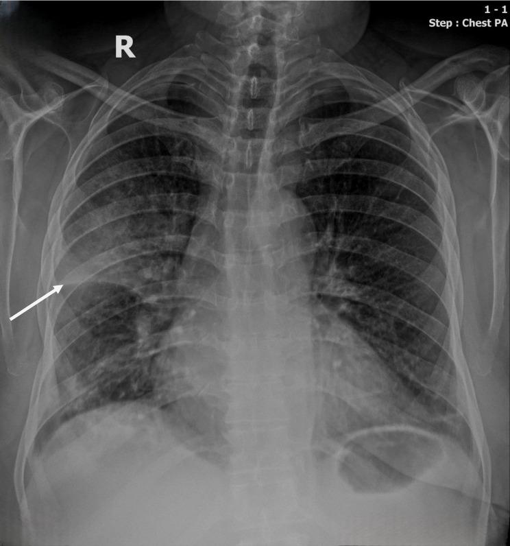 https://cdn.ncbi.nlm.nih.gov/pmc/blobs/eca7/11537182/b785c7c83ef2/IMCRJ-17-895-g0001.jpg