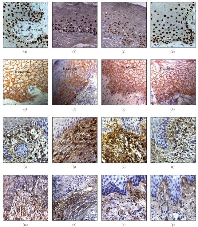 https://cdn.ncbi.nlm.nih.gov/pmc/blobs/ecae/3092180/a6d76b5853b9/ECAM2011-239864.003.jpg