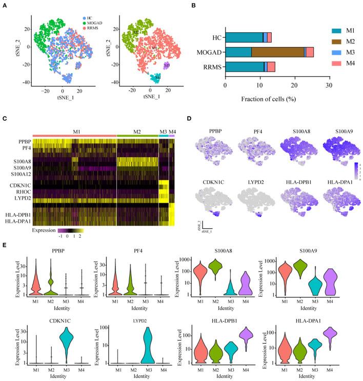 https://cdn.ncbi.nlm.nih.gov/pmc/blobs/ecb0/8795627/a1da37992db2/fneur-12-807646-g0002.jpg