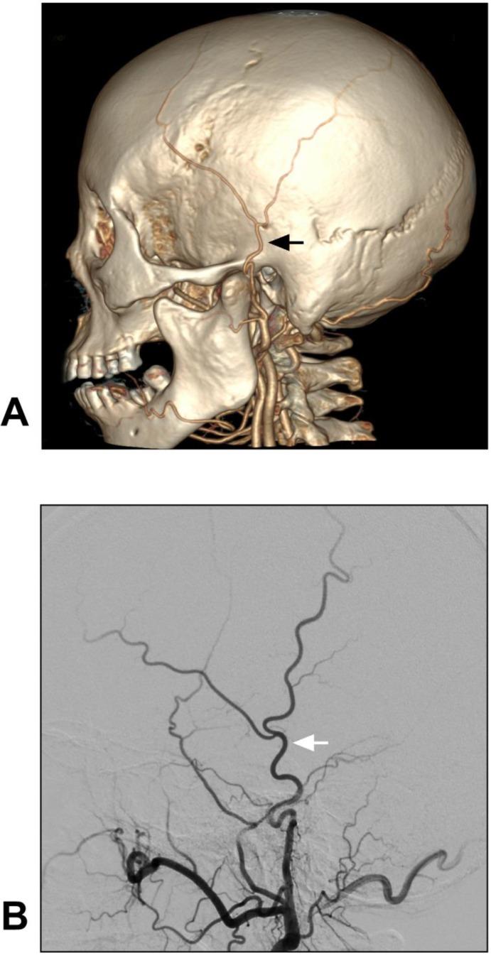 https://cdn.ncbi.nlm.nih.gov/pmc/blobs/ecb4/6818193/53321021e21b/ijmsv16p1377g002.jpg