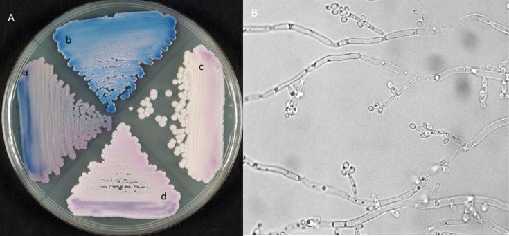 https://cdn.ncbi.nlm.nih.gov/pmc/blobs/ecb7/6141729/bfb9c13544a6/gr2.jpg