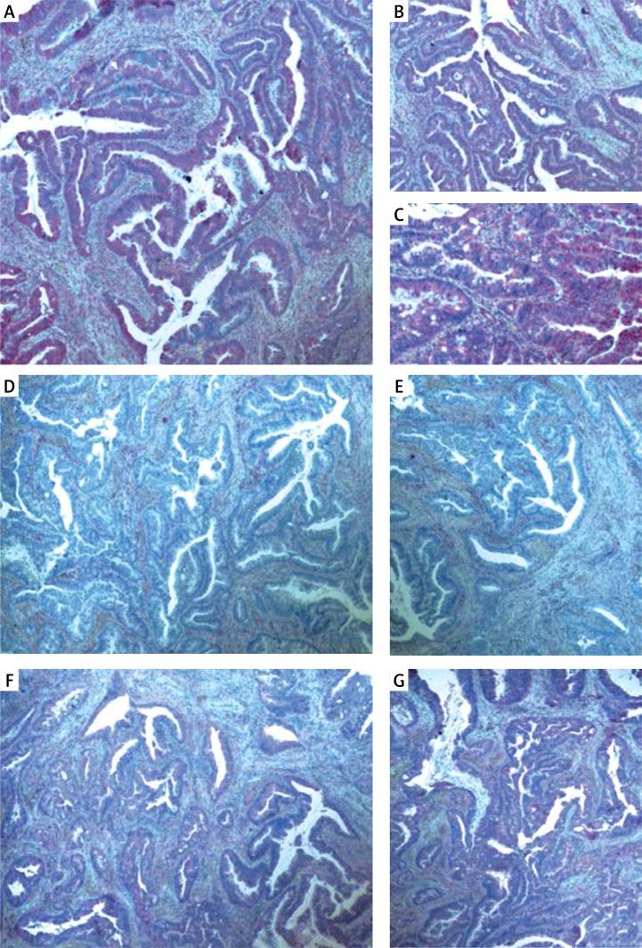 https://cdn.ncbi.nlm.nih.gov/pmc/blobs/ecc4/6300847/1e49fdab5e1f/PG-13-34210-g001.jpg