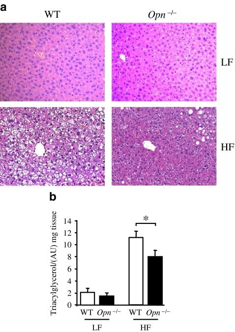 https://cdn.ncbi.nlm.nih.gov/pmc/blobs/ecc7/3131508/d4c3f13ea634/125_2011_2170_Fig1_HTML.jpg