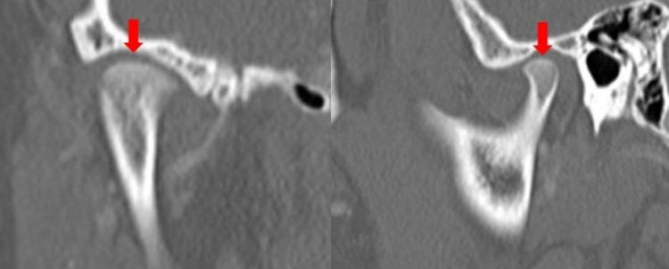 https://cdn.ncbi.nlm.nih.gov/pmc/blobs/ecc8/9605739/08cdb869219c/cureus-0014-00000029624-i03.jpg