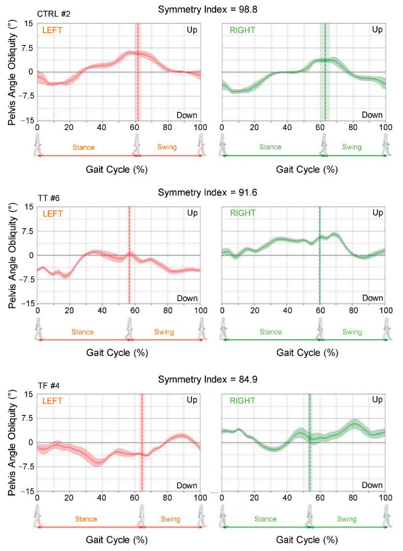 https://cdn.ncbi.nlm.nih.gov/pmc/blobs/eccd/8747521/f02c6d798e09/sensors-22-00095-g003.jpg
