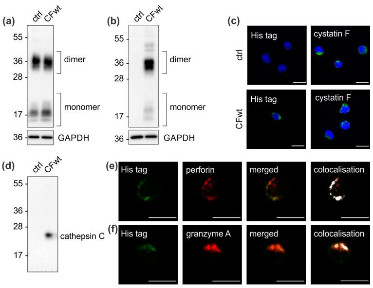 https://cdn.ncbi.nlm.nih.gov/pmc/blobs/ecd1/7762138/4a9047f676b5/cancers-12-03660-g001.jpg