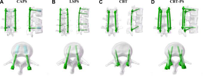 https://cdn.ncbi.nlm.nih.gov/pmc/blobs/ecd2/10646582/435facb8d938/fbioe-11-1268557-g002.jpg