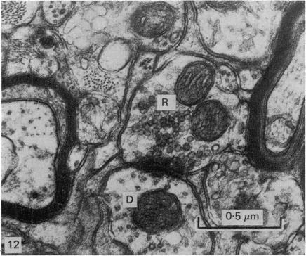 https://cdn.ncbi.nlm.nih.gov/pmc/blobs/ecd7/1233131/0a483f04cf9a/janat00234-0048-b.jpg