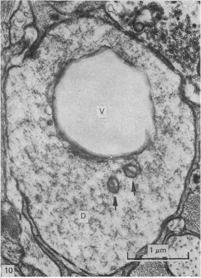 https://cdn.ncbi.nlm.nih.gov/pmc/blobs/ecd7/1233131/719bbccc0f12/janat00234-0047-c.jpg