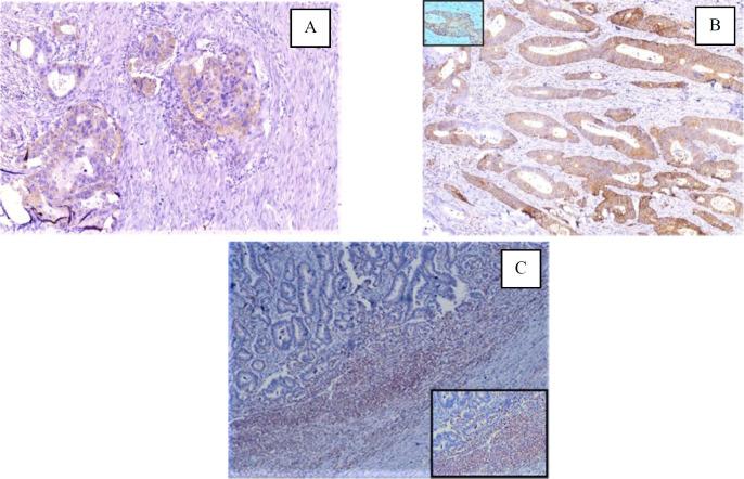 https://cdn.ncbi.nlm.nih.gov/pmc/blobs/ecda/11164304/d444862515f5/ijp-19-22-g001.jpg