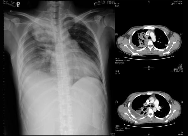 https://cdn.ncbi.nlm.nih.gov/pmc/blobs/ecdd/2976737/961cdd74bee1/1749-8090-5-88-2.jpg