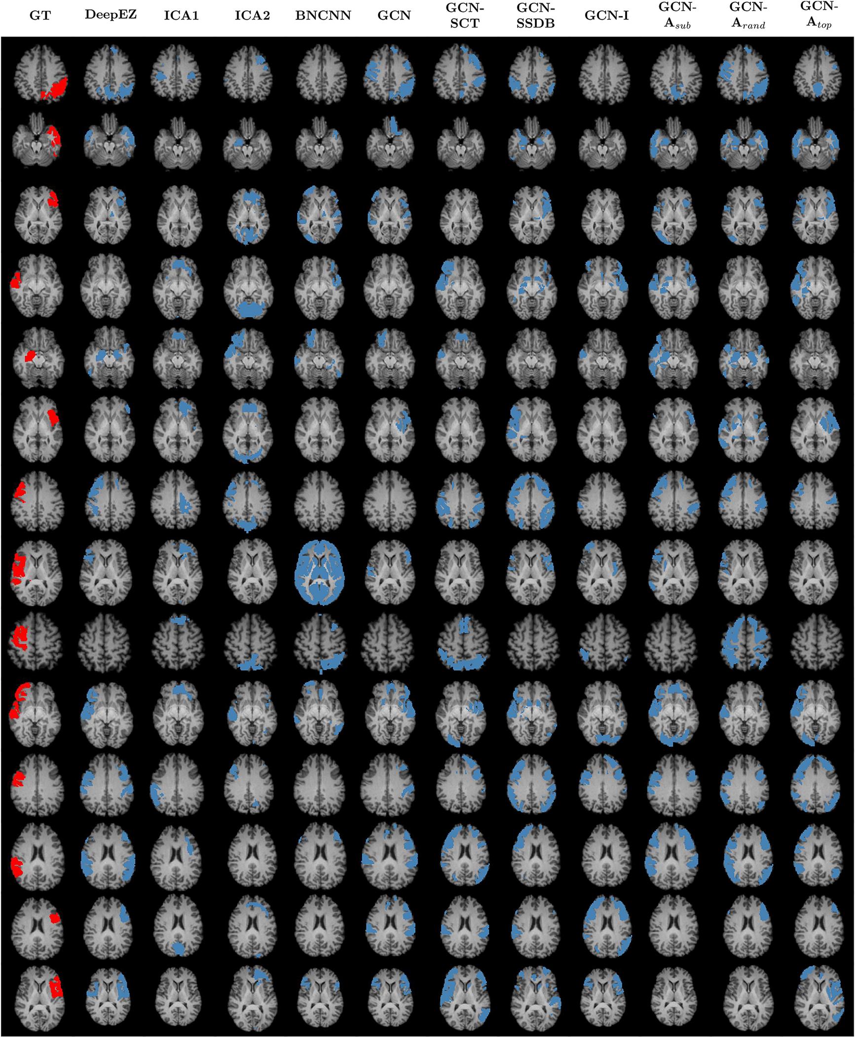 https://cdn.ncbi.nlm.nih.gov/pmc/blobs/ecdd/9841829/caa5c079cdde/nihms-1860979-f0004.jpg