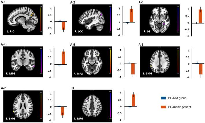 https://cdn.ncbi.nlm.nih.gov/pmc/blobs/ecde/10248065/a61a094c1a86/fpsyt-14-1205126-g0001.jpg
