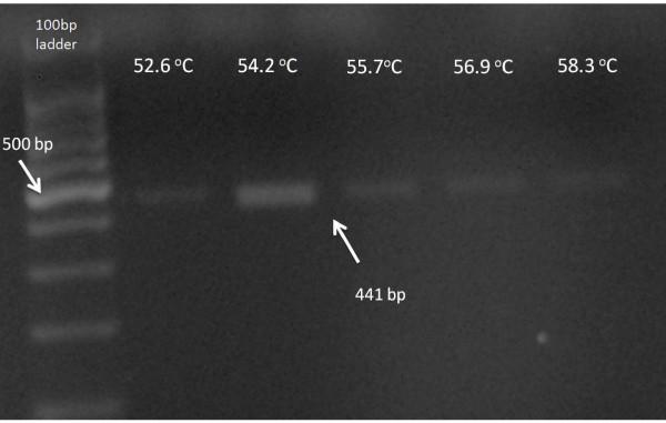 https://cdn.ncbi.nlm.nih.gov/pmc/blobs/ece9/3212932/74633487dde4/1749-8090-6-137-1.jpg