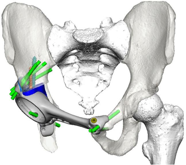 https://cdn.ncbi.nlm.nih.gov/pmc/blobs/eced/12394299/fd862cd708da/402_2025_6008_Fig1_HTML.jpg