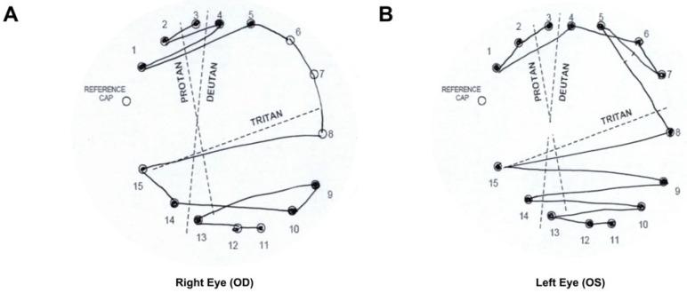 https://cdn.ncbi.nlm.nih.gov/pmc/blobs/ecee/10672672/58306739335e/jcm-12-06960-g002.jpg