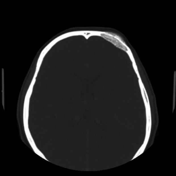 https://cdn.ncbi.nlm.nih.gov/pmc/blobs/ecf6/3665882/42175935bfa0/aps-40-283-g001.jpg